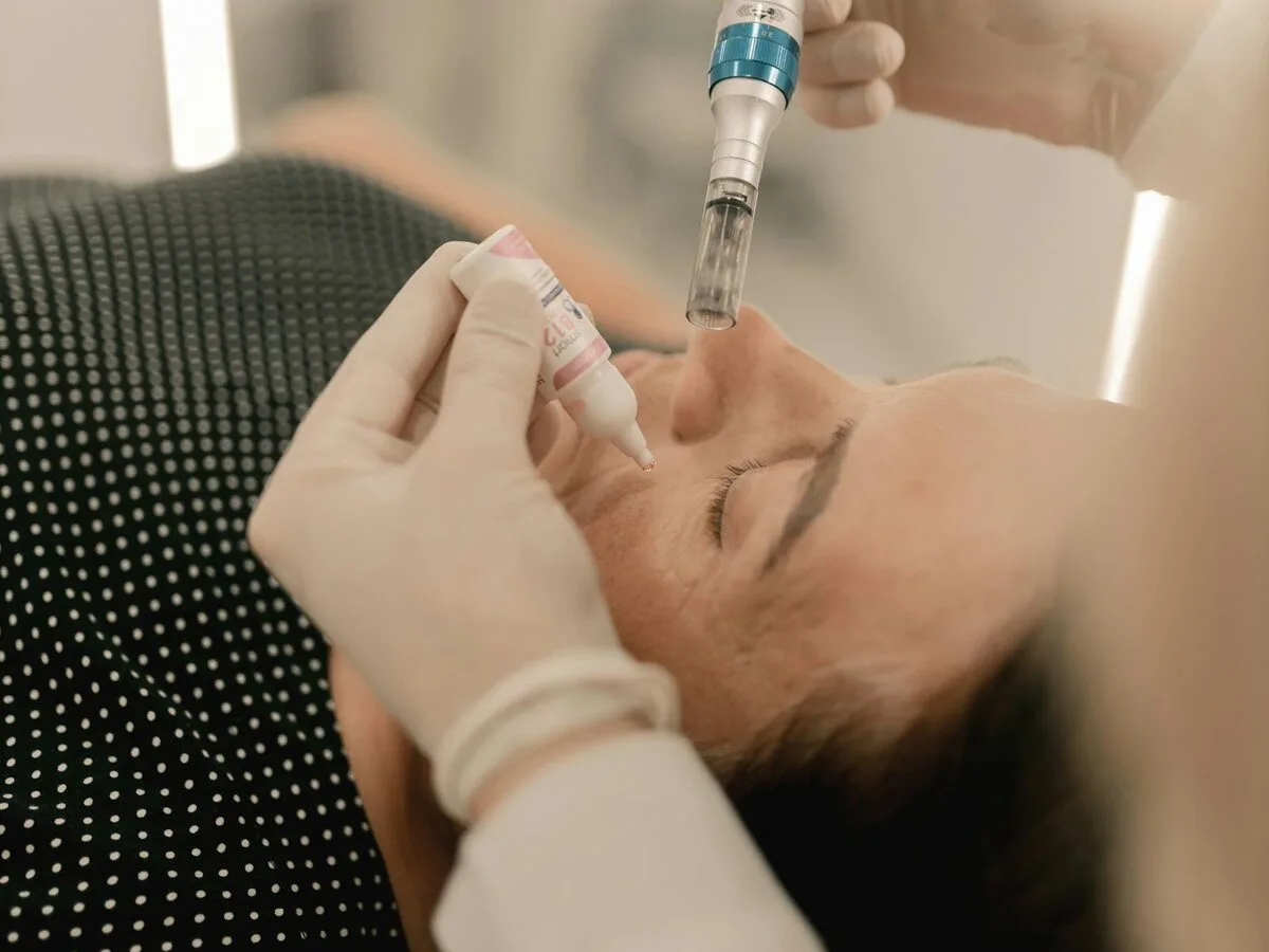 Microneedling
